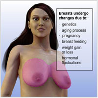 breast-lift-surgery01